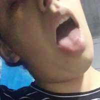 abyrodr Naken