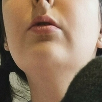 frillymillyx Naken