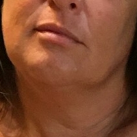 Lady Lara Naken