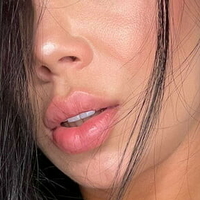 lopezeli Naken