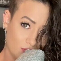rocking_alopecia Naken